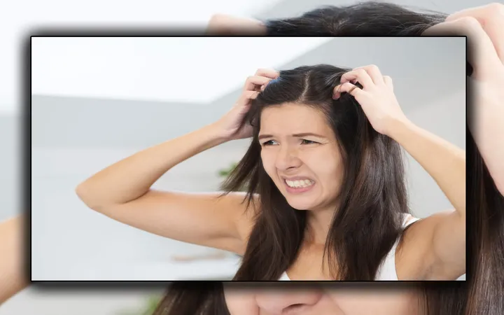 Atasi Gatal Kulit Kepala? 5 Tips Ampuh Bikin Percaya Diri