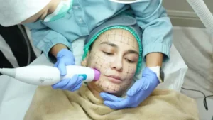 Rahasia Kecantikan Luna Maya & Maxime: Persiapan Pernikahan, Lifting & Laser